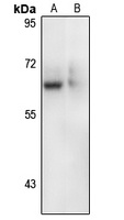 CRMP-5 antibody