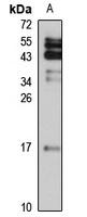 Destrin antibody