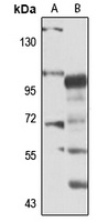 RIP5 antibody