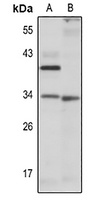 DUSP2 antibody