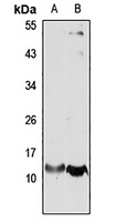 DNLC2A antibody
