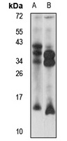 DYNLT3 antibody