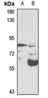 Anti-E2F8 Antibody