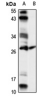 Anti-EAF1 Antibody