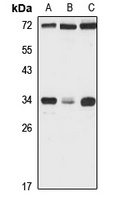 Anti-ECH1 Antibody