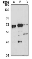 Anti-EED Antibody
