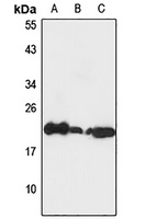 Anti-EEF1E1 Antibody