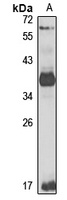 Anti-eIF3 beta Antibody