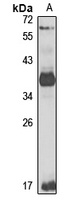 eIF3 beta antibody