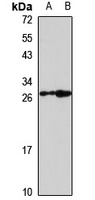 Anti-Neutrophil Elastase Antibody