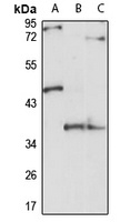 RBM29 antibody