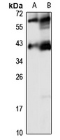 Anti-ELP5 Antibody