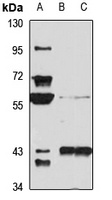 Anti-ENC1 Antibody