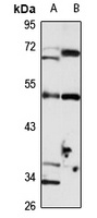 ENPP4 antibody