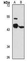 Anti-CD39L2 Antibody