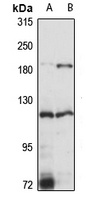 Anti-EPAS1 Antibody