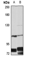EPB41L3 antibody