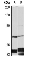 Anti-EPB41L3 Antibody