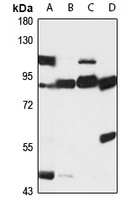 Anti-EPN1 Antibody