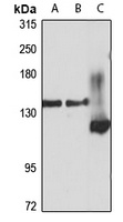 Anti-ERC1 Antibody