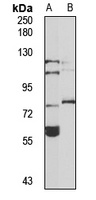 TFIIH p89 antibody