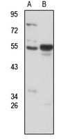 Anti-ERVW-1 Antibody