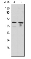 Anti-ERR gamma Antibody