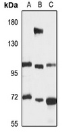 Anti-E-Syt2 Antibody