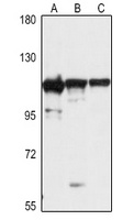Anti-EXOSC10 Antibody