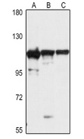 EXOSC10 antibody