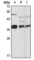Anti-EXOSC7 Antibody