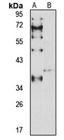 EXTL2 antibody