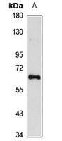 Anti-EYA2 Antibody