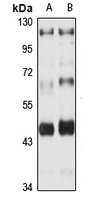 Anti-PAR2 Antibody