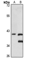 Anti-FAAH Antibody