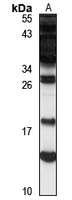 Anti-DRR1 Antibody