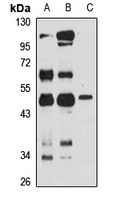 Anti-FAM46A Antibody