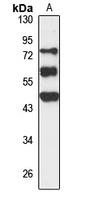 Anti-FAM83A Antibody