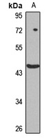 FBXW4 antibody