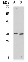 Ficolin 2 antibody