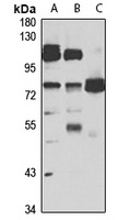 Anti-FERMT3 Antibody