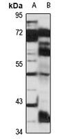Anti-FEZF2 Antibody