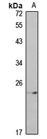 Anti-FGF10 Antibody