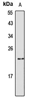 Anti-FGF7 Antibody