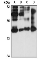 Anti-HYPE Antibody