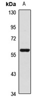 Anti-FLVCR1 Antibody