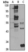 Anti-FLVCR2 Antibody