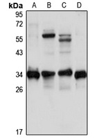 Anti-FN3KRP Antibody