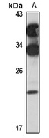 Anti-FOPNL Antibody