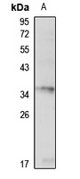 FOXB1 antibody